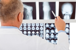 A Doctor Examining a Broken Bone on an X-ray